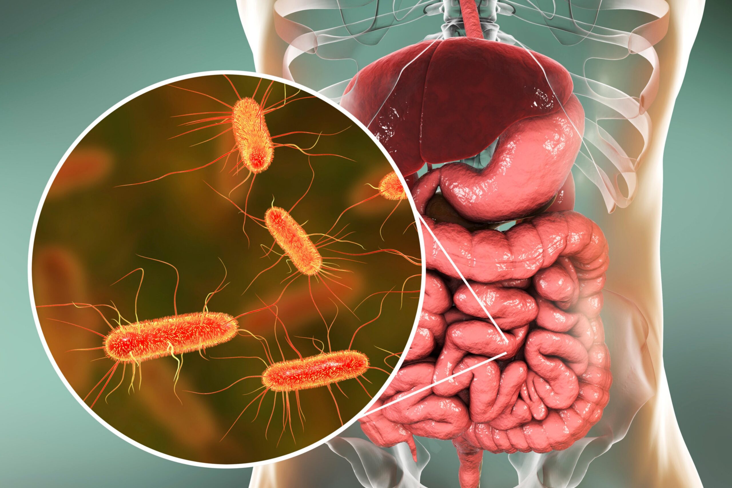 Helicobacter pylori – objawy, diagnostyka, leczenie i dieta